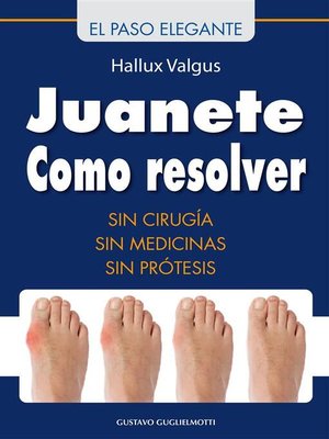 cover image of Juanete--Resolver sin cirugía